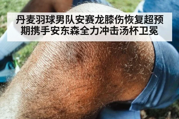 丹麦羽球男队安赛龙膝伤恢复超预期携手安东森全力冲击汤杯卫冕